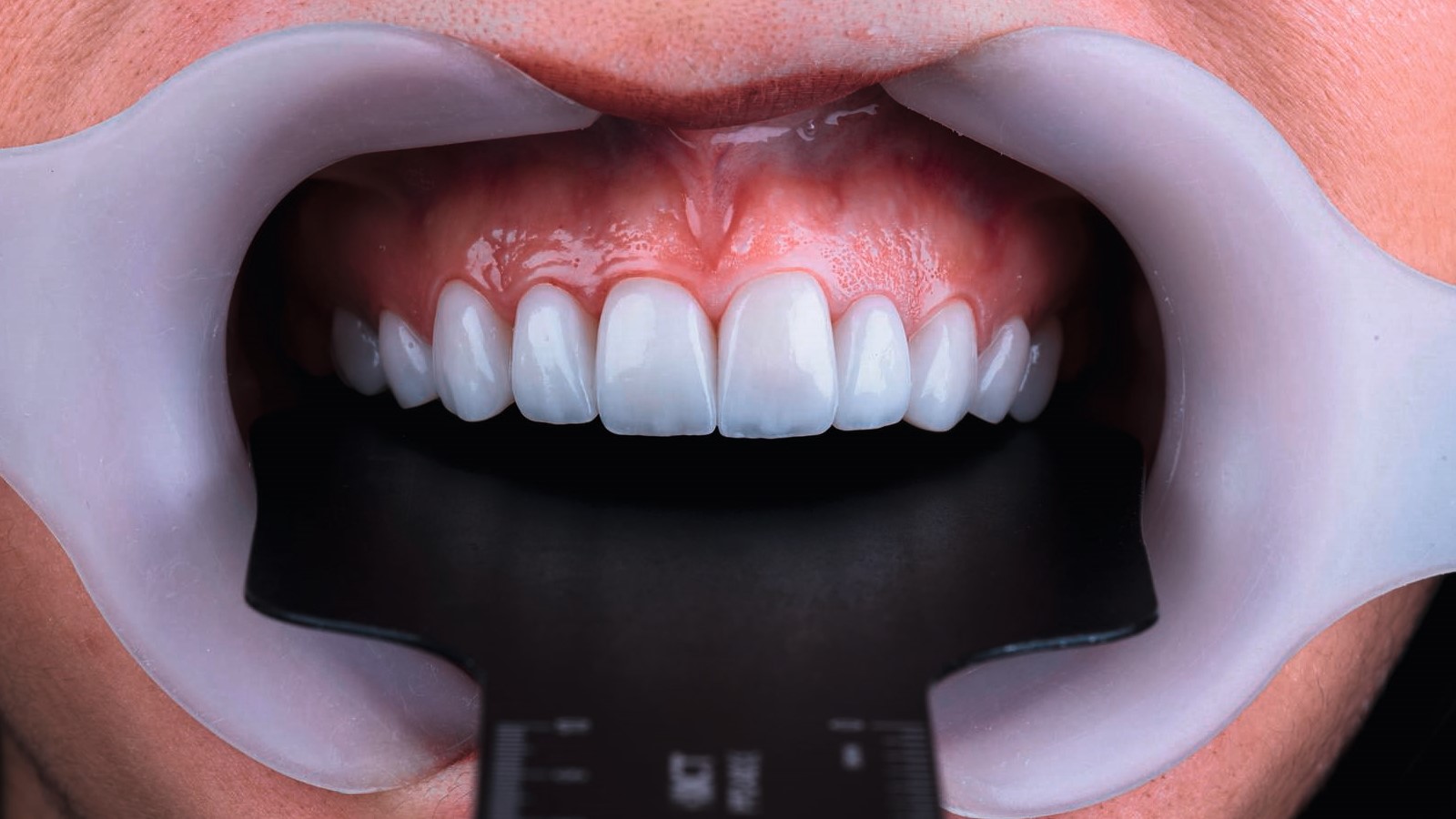 Photography Tips for Stunning Results