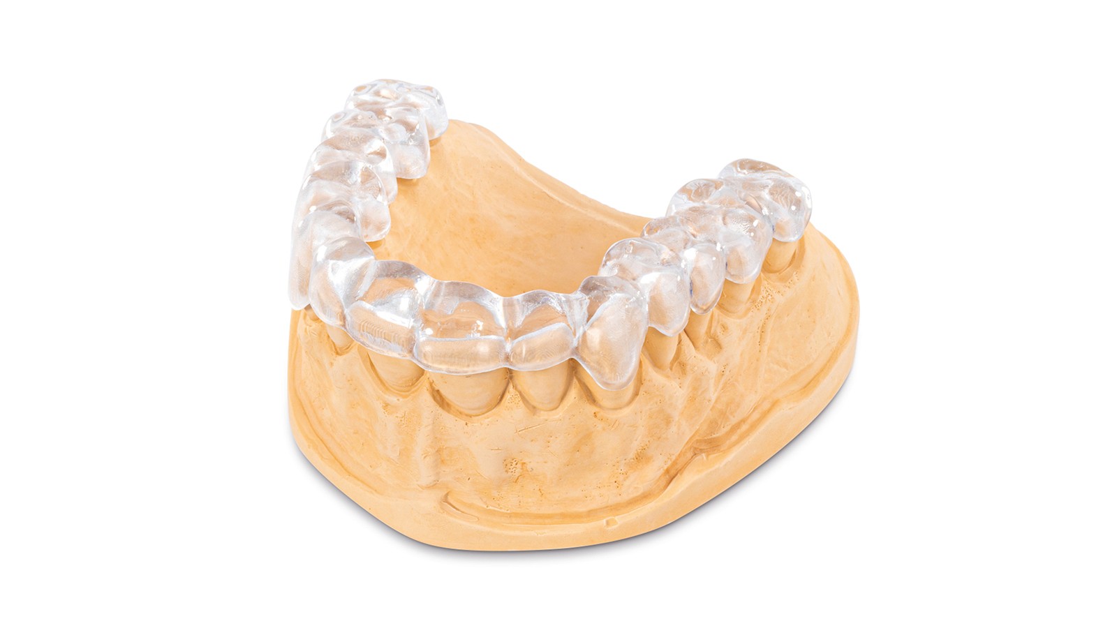 Invisible, crystal-clear 3D-printed splints with a perfect fit