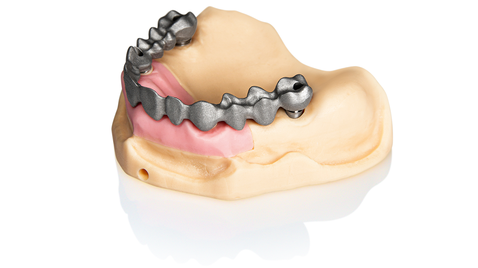 3D printed implant models