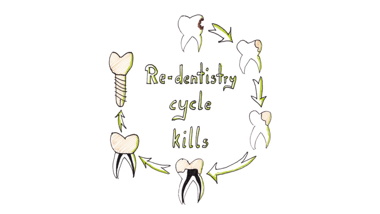 Re-dentistry cycle kills Re-dentistry cycle kills