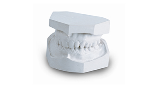 Modern Materials 0-67 Snow White Orthodontic Stone