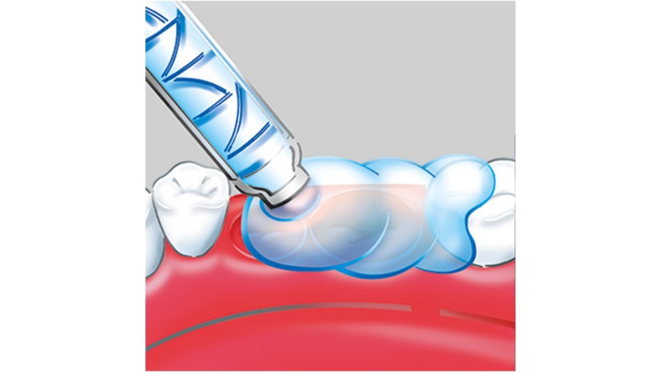 MEMOSIL 2 - the expert for special indications