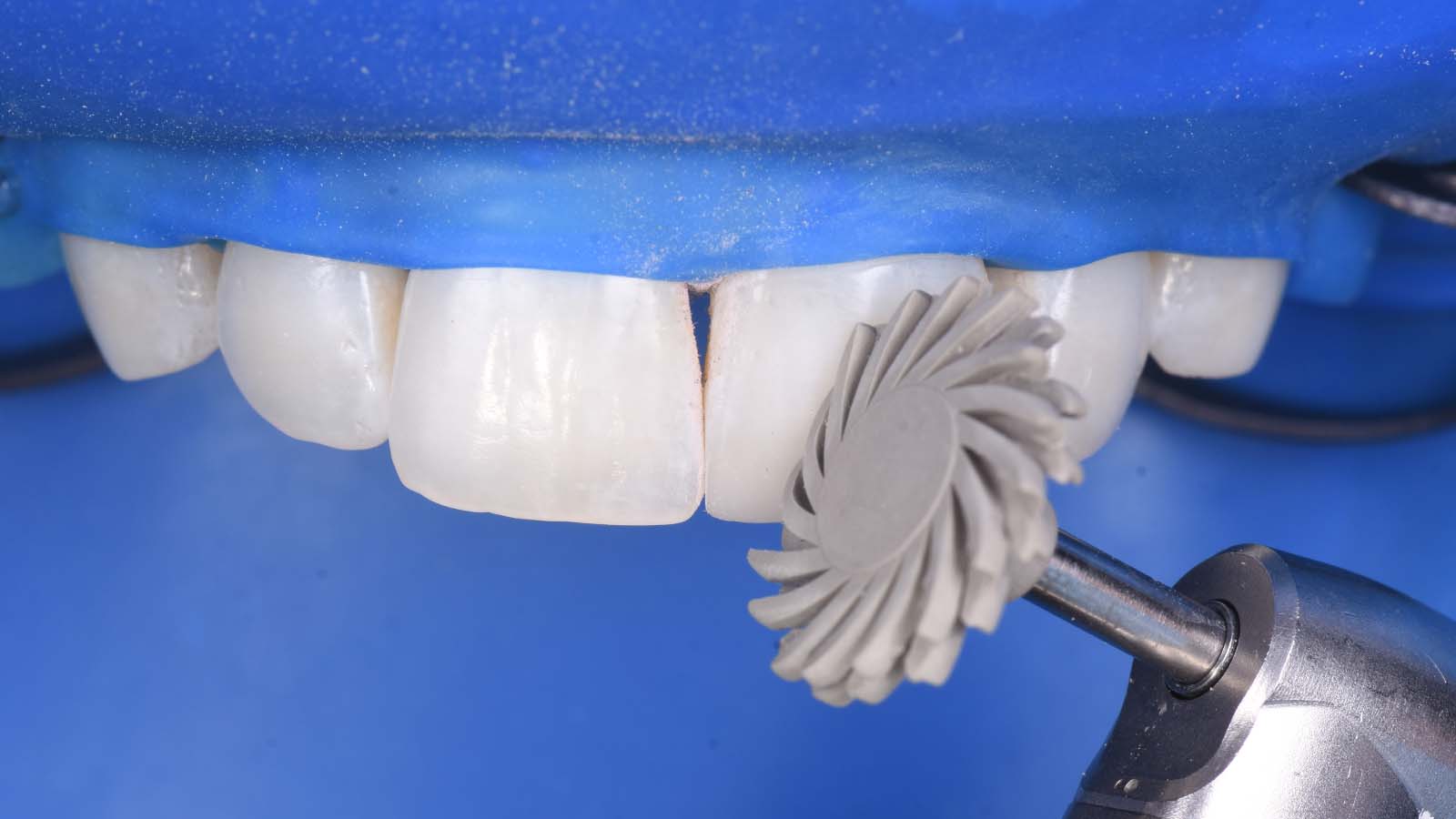 Continuing with the grey high-gloss polisher.