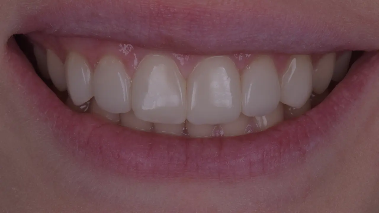 Result after 4 years, following a quick repolish